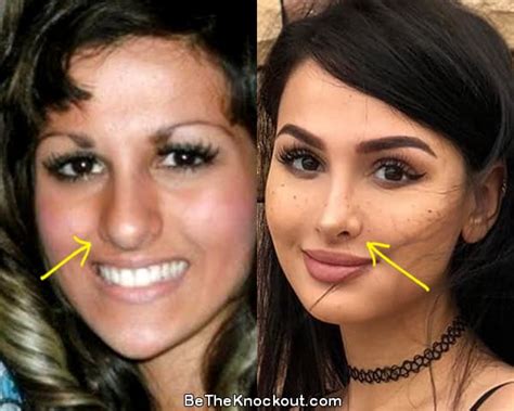 sssniperwolf before after|SSSniperwolf Plastic Surgery Comparison Photos